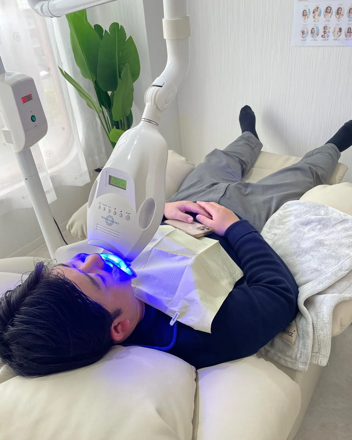 Data▼男性のホワイトニング