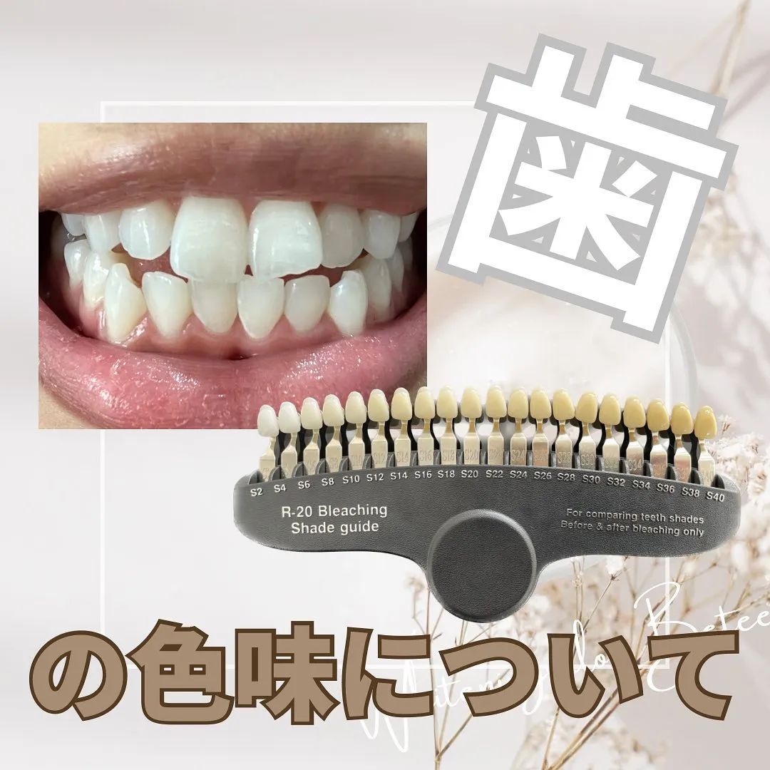 Data▼ 歯の色味について