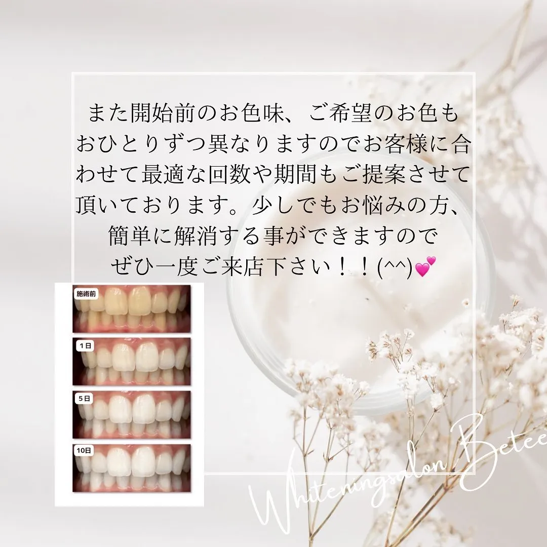 Data▼ 歯の色味について