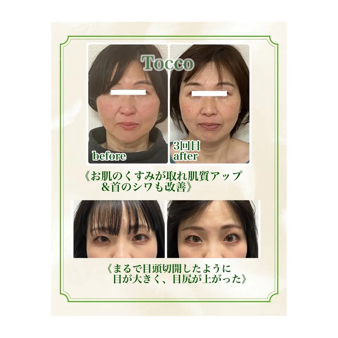 Data▼ 当サロンで受けられるサービスについて