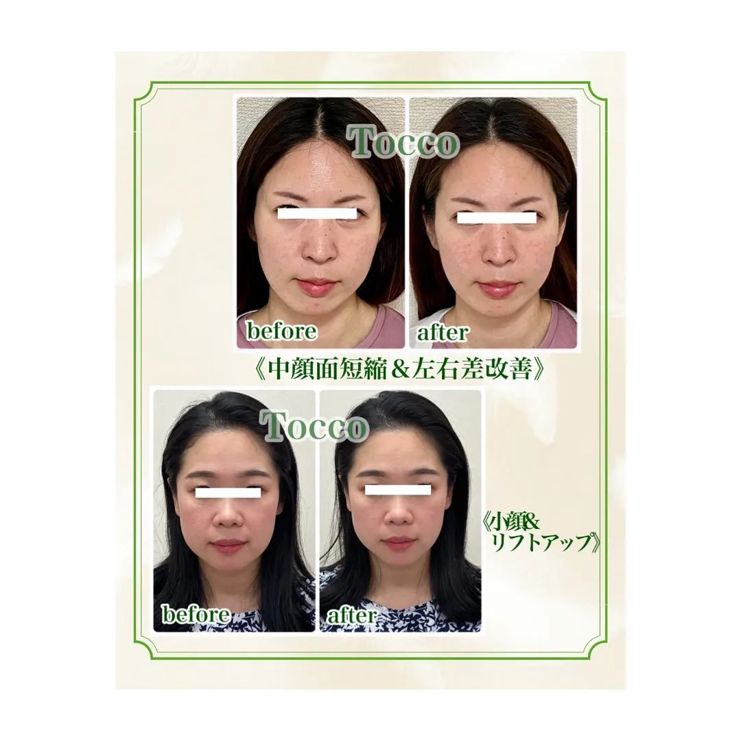 Data▼ 当サロンで受けられるサービスについて