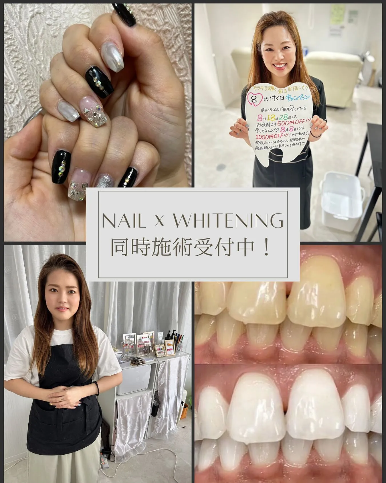 Data▼ネイル×ホワイトニング　同時施術について