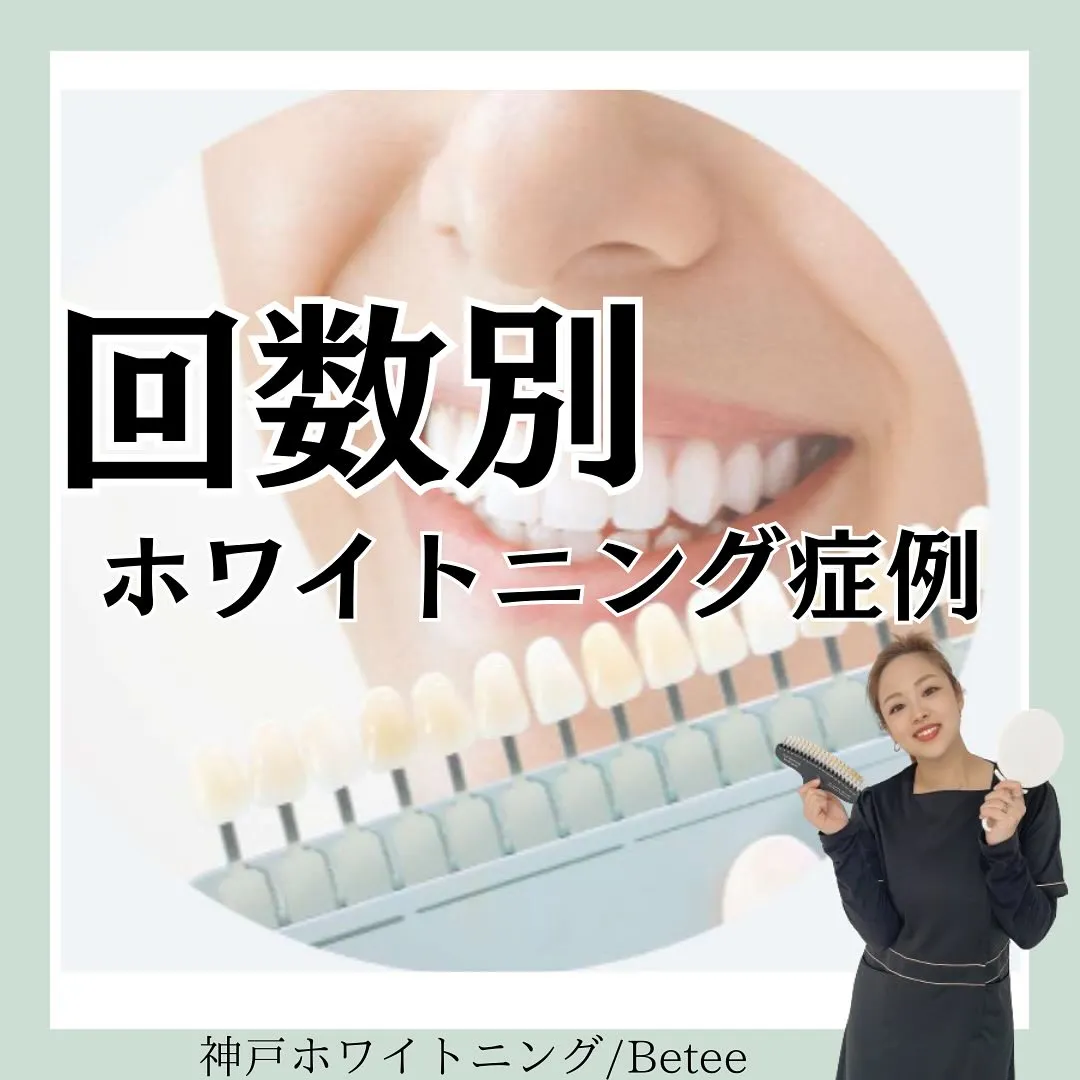 @whitening_betee