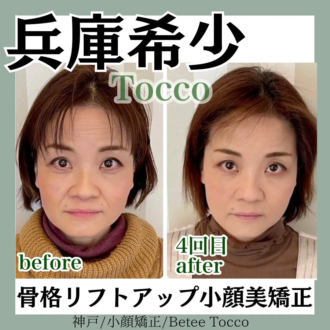 【骨格リフトアップ美矯正】