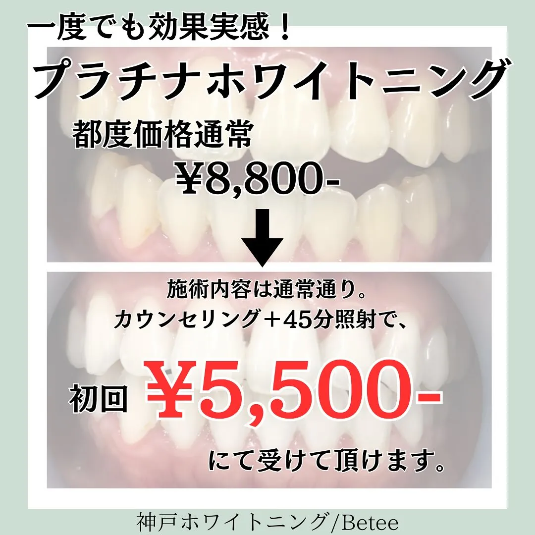 @whitening_betee ホワイトニング