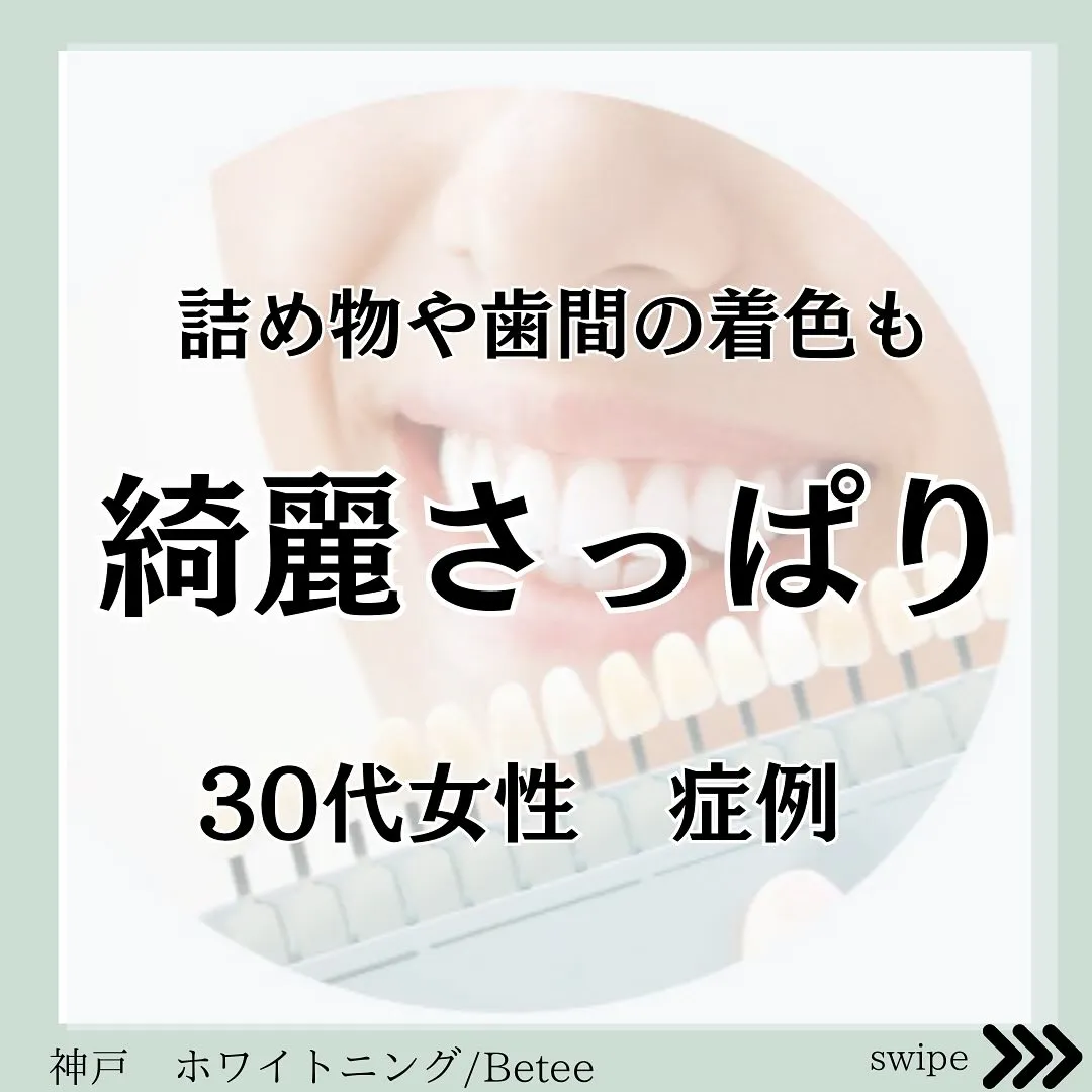 @whitening_betee ホワイトニング