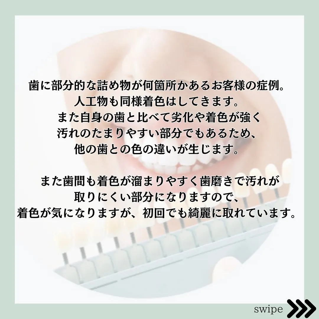 @whitening_betee ホワイトニング