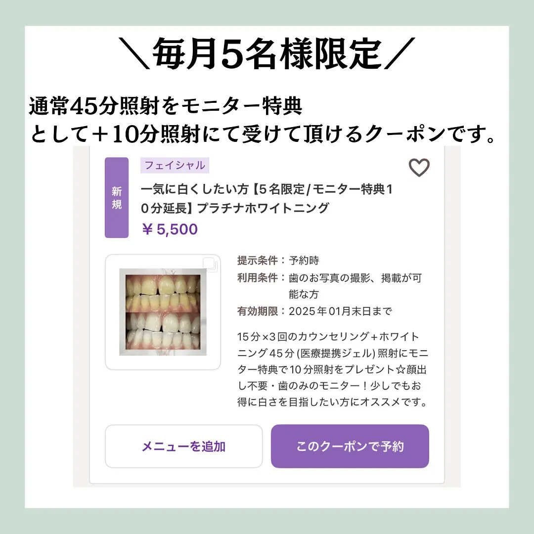@whitening_betee ホワイトニング