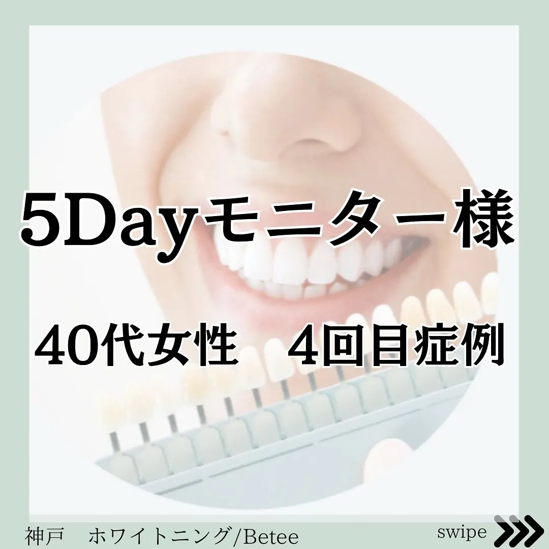 @whitening_betee ホワイトニング