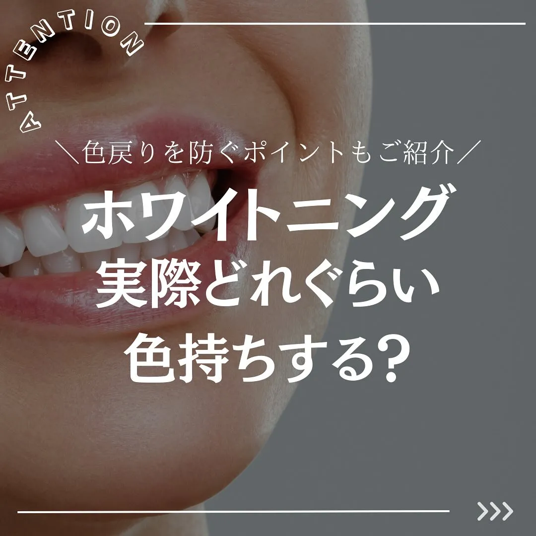 @whitening_betee ホワイトニング