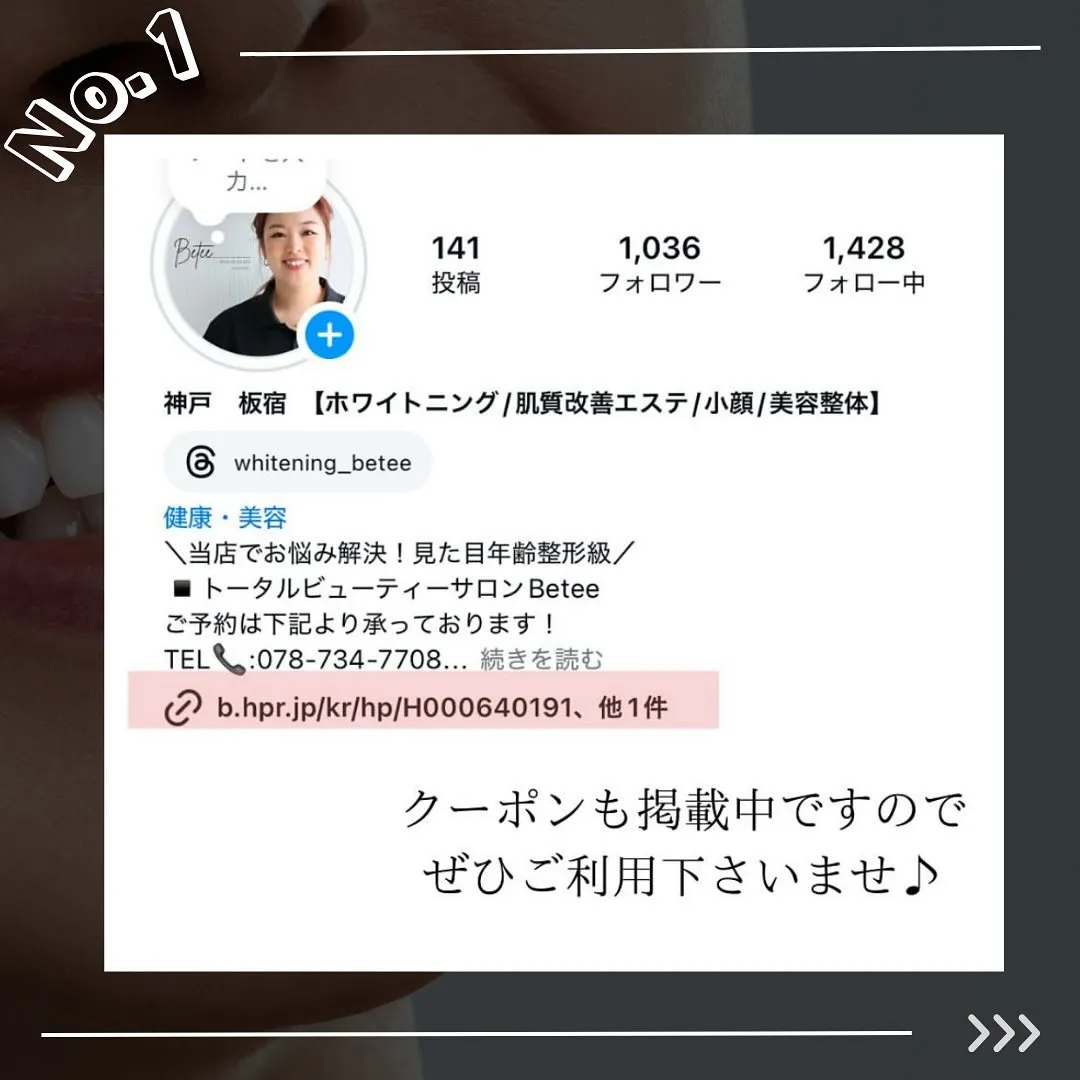 @whitening_betee ホワイトニング