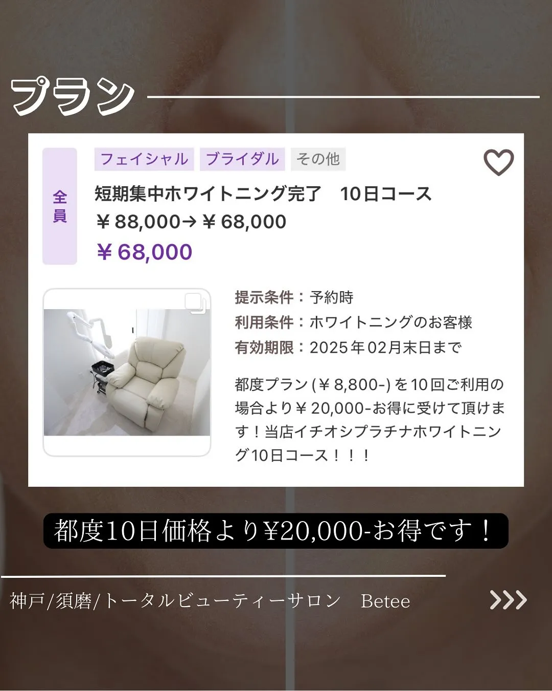 @whitening_betee ホワイトニング