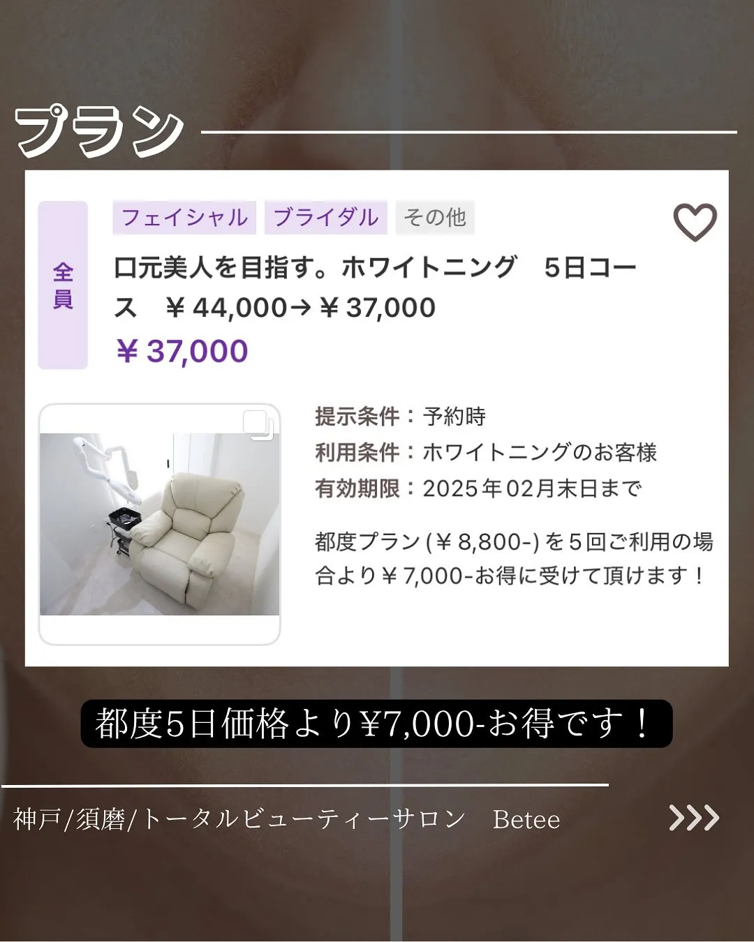 @whitening_betee ホワイトニング