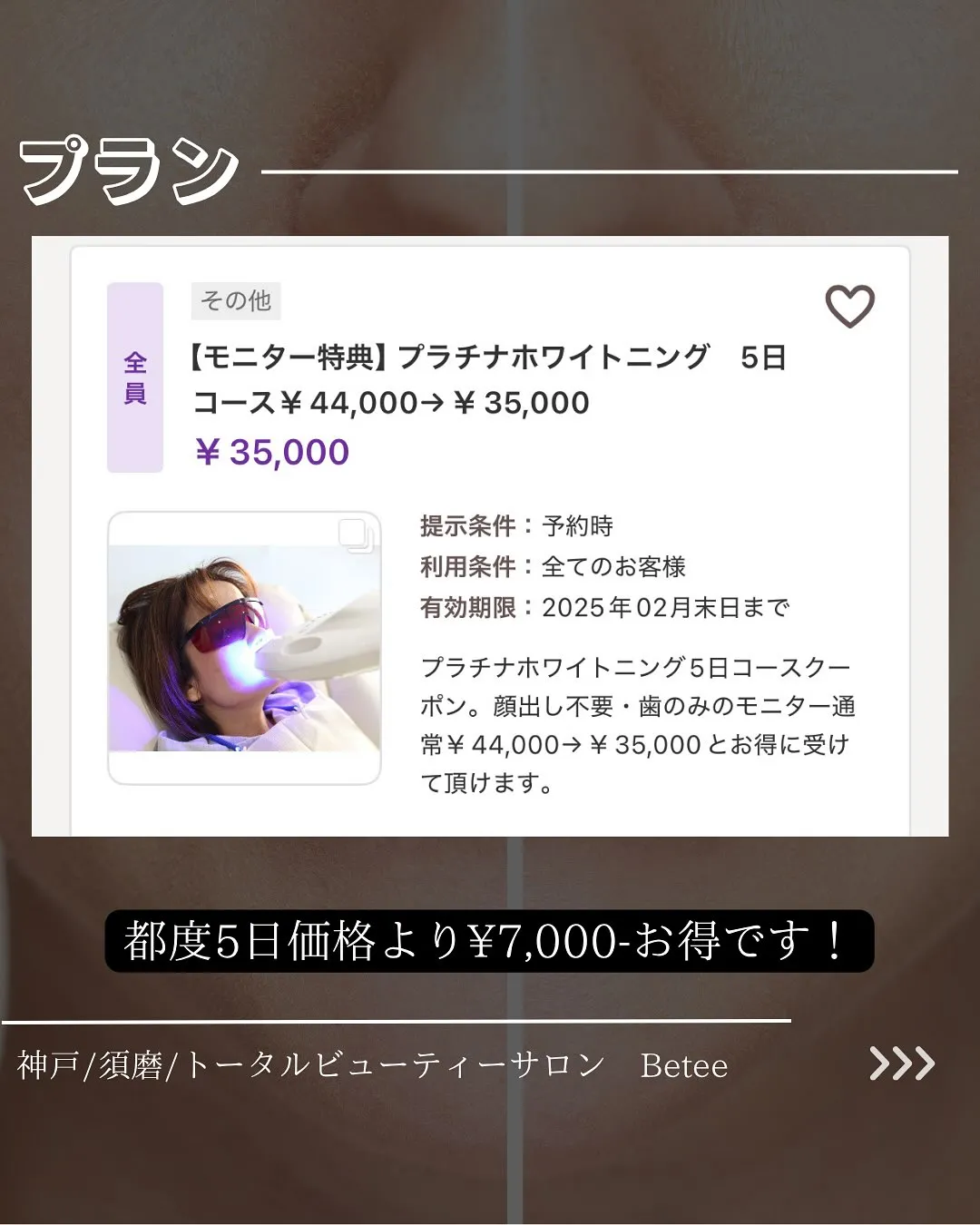 @whitening_betee ホワイトニング