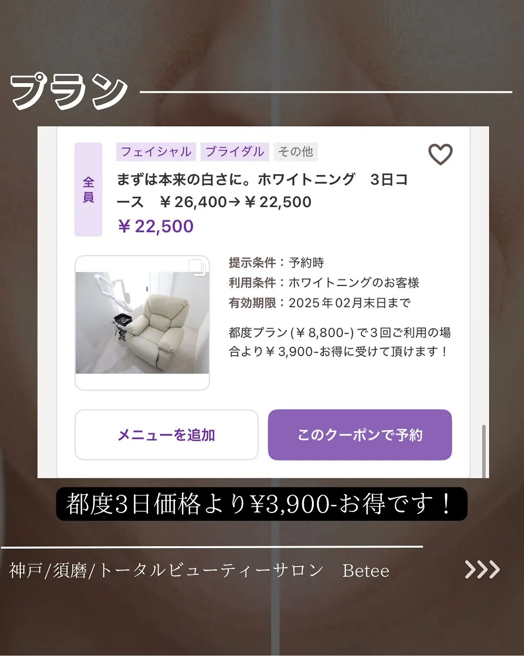 @whitening_betee ホワイトニング