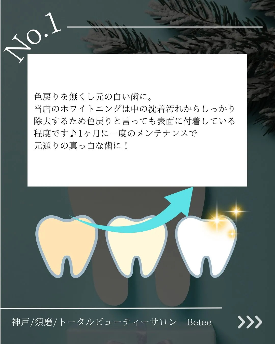 @whitening_betee ホワイトニング