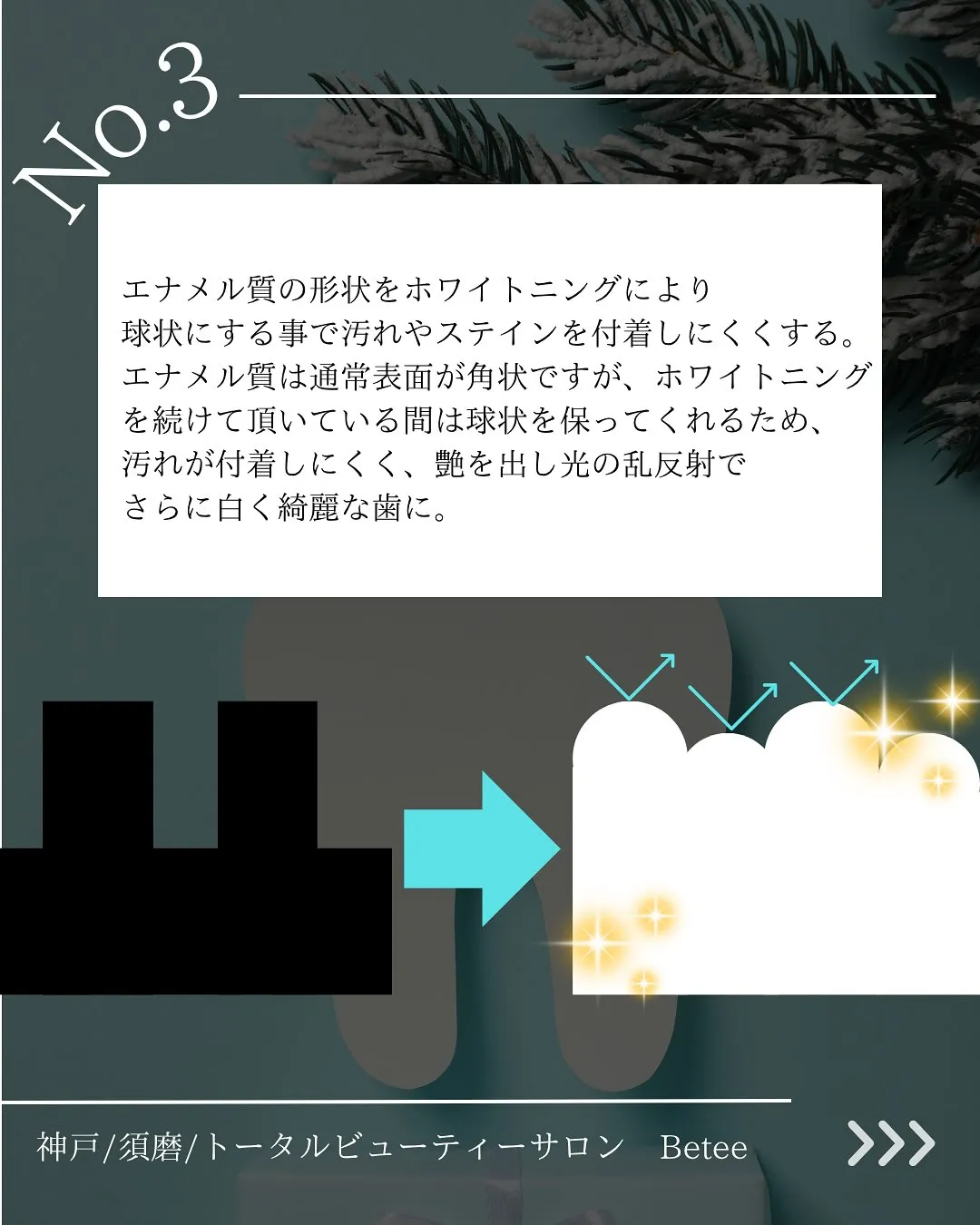 @whitening_betee ホワイトニング