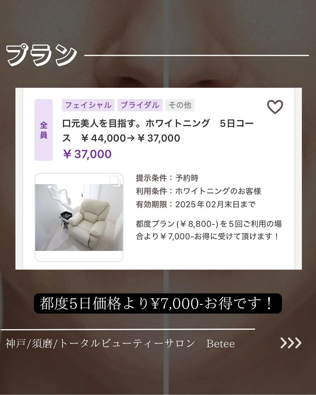 @whitening_betee ホワイトニング