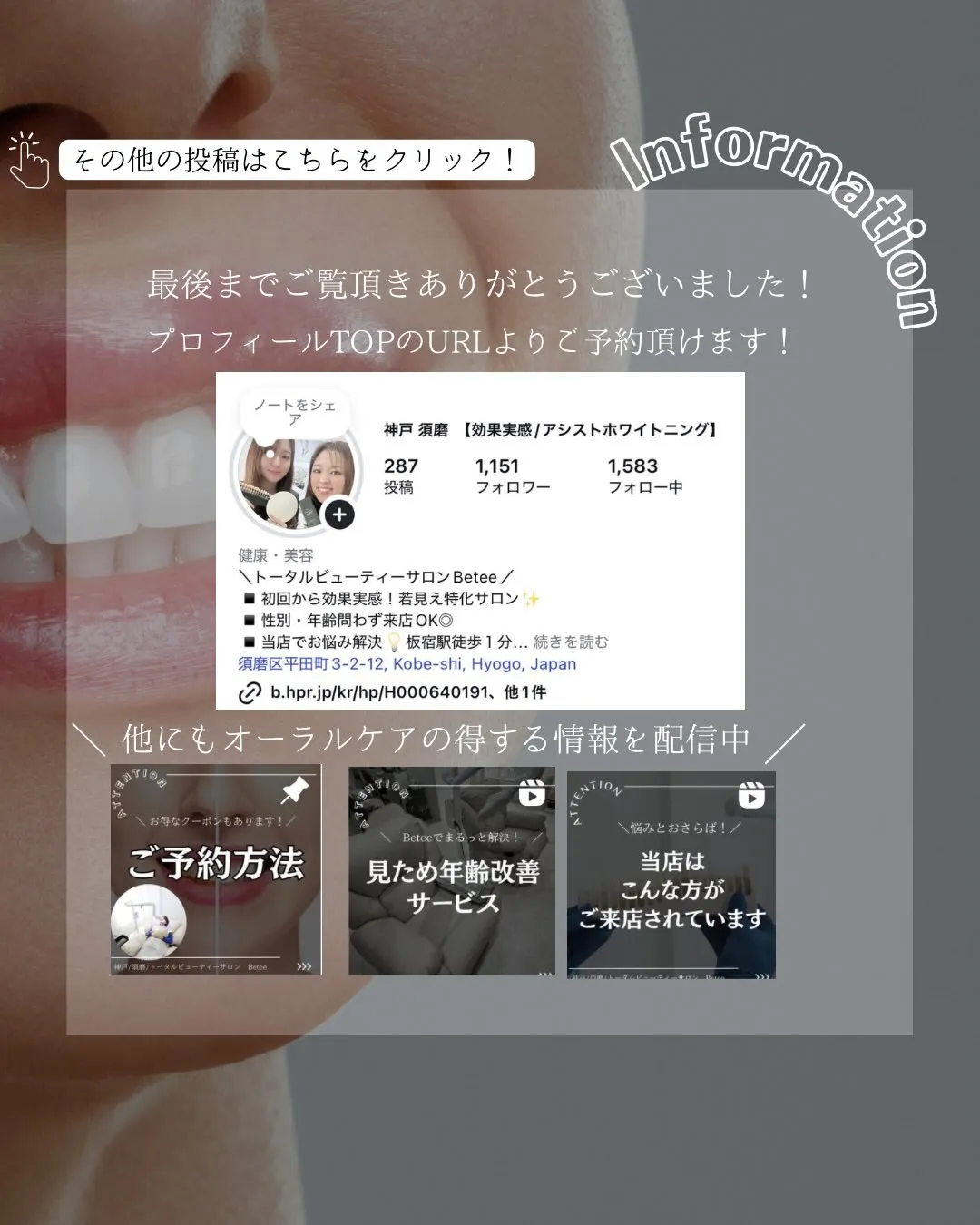 @whitening_betee