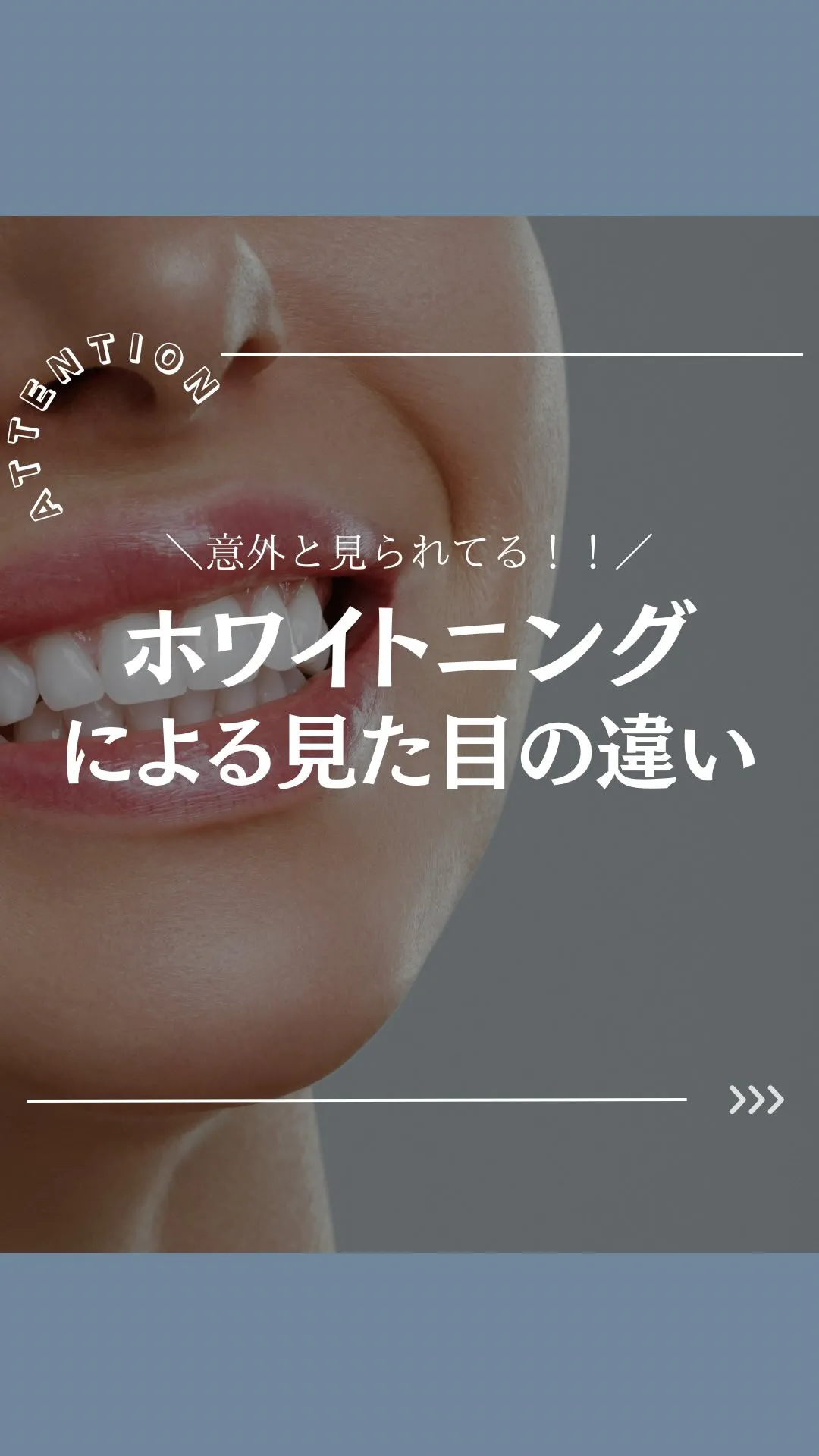 @whitening_betee ホワイトニング