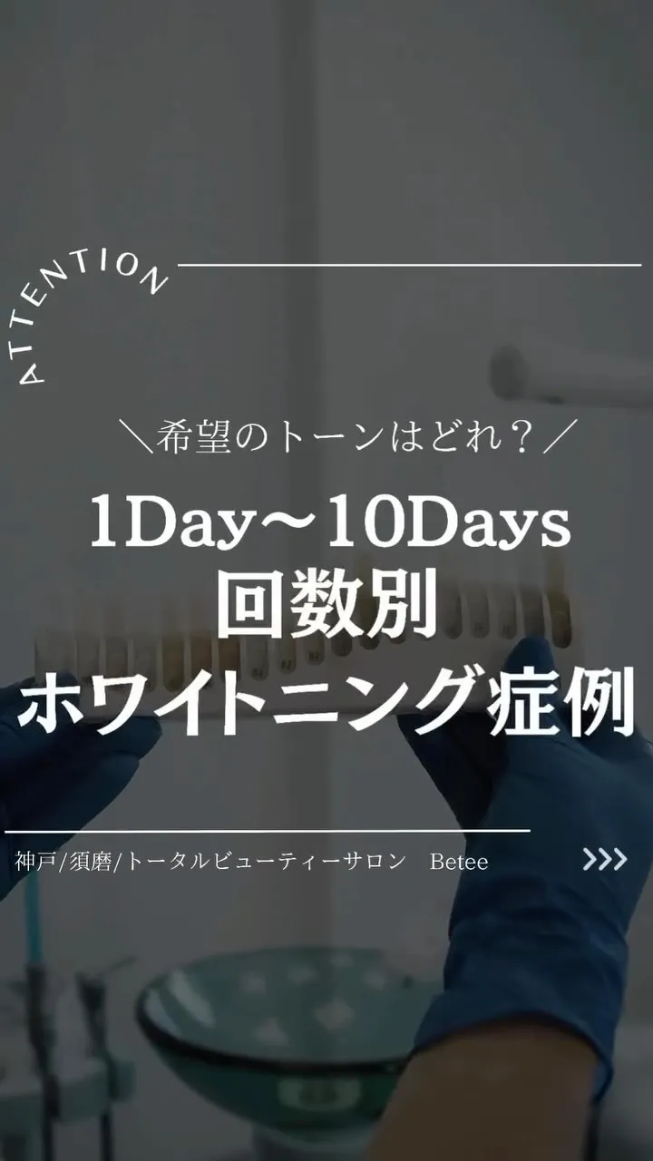 @whitening_betee ホワイトニング