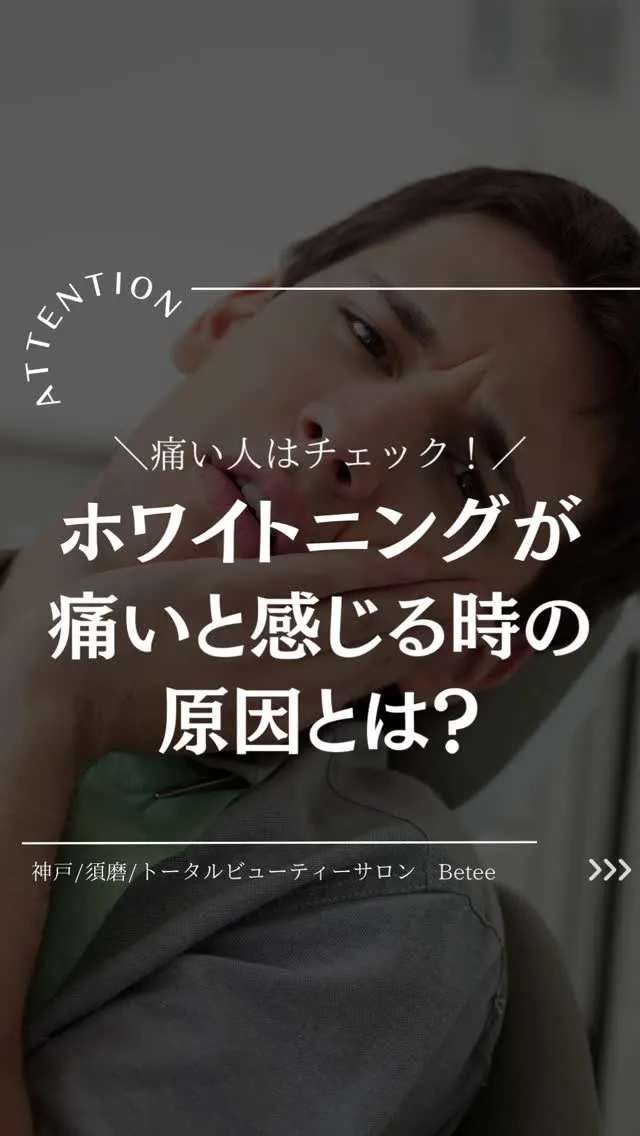 @whitening_betee ホワイトニング