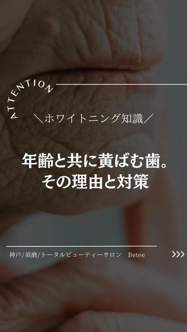 @whitening_betee 