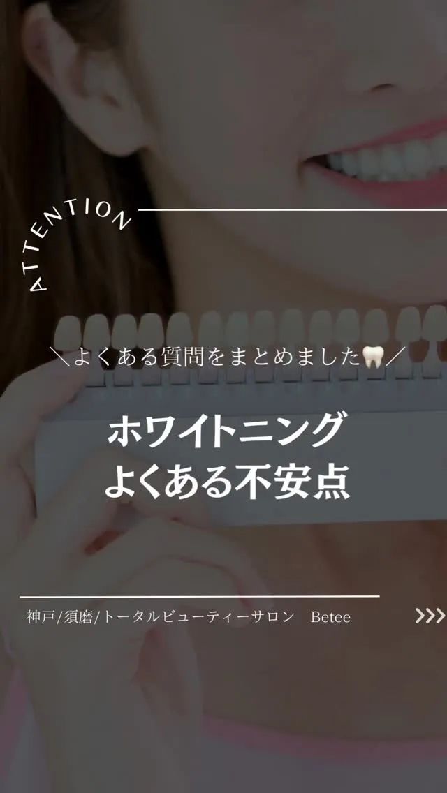 【初めてのホワイトニングでよくある不安🦷】