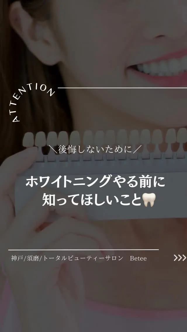 【ホワイトニングやる前に知ってほしいこと🦷】