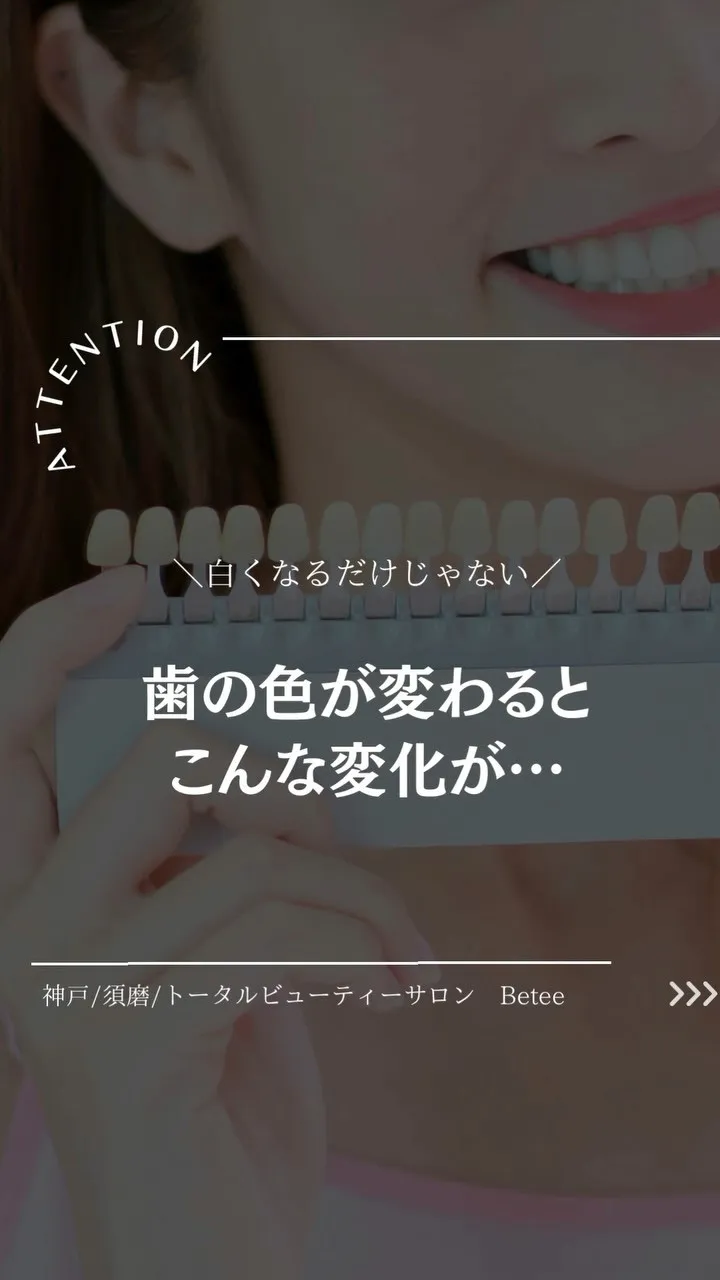 @whitening_betee 